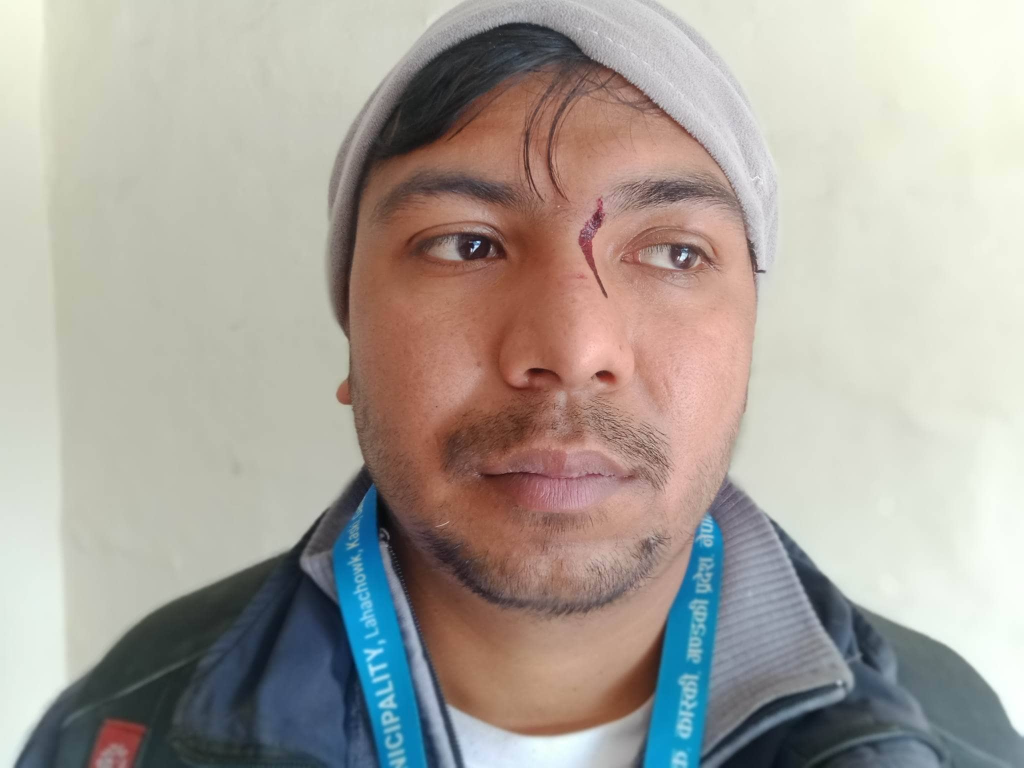 कास्कीमा वडाध्यक्षले कुटपिट गरेको भन्दै सवइन्जिनियरले दिए उजुरी